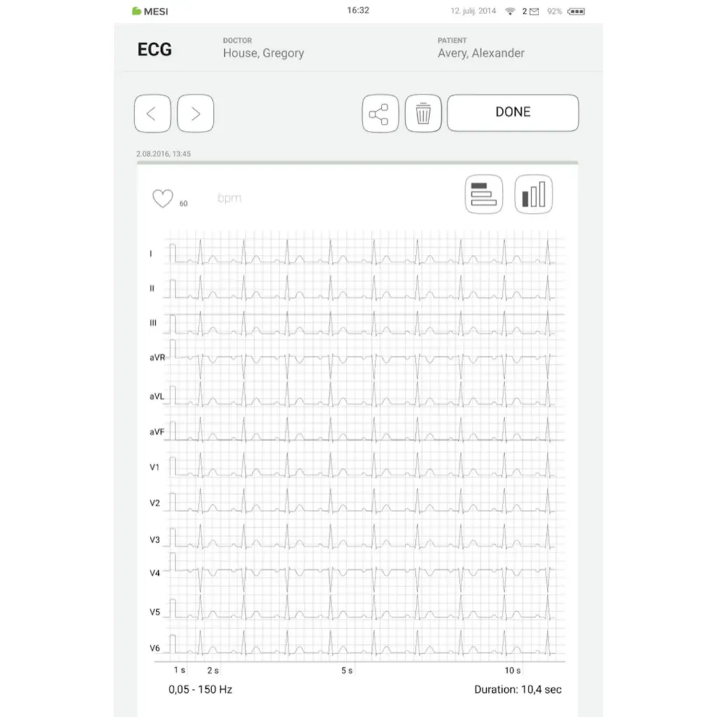 ECG 2.webp